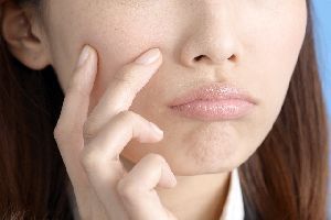 「めんちょう」のできる原因
